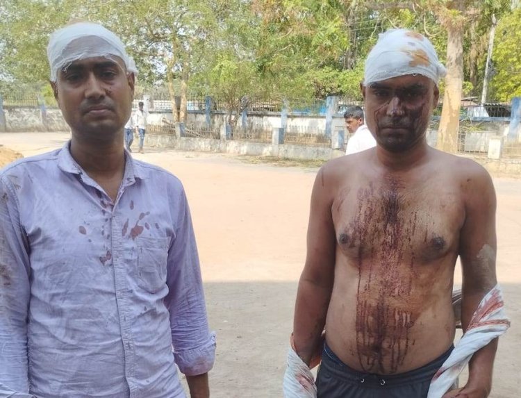 मामूली विवाद में रणक्षेत्र बना कंझरूआ गांव, दोनों पक्षों के कुल चार जख्मी