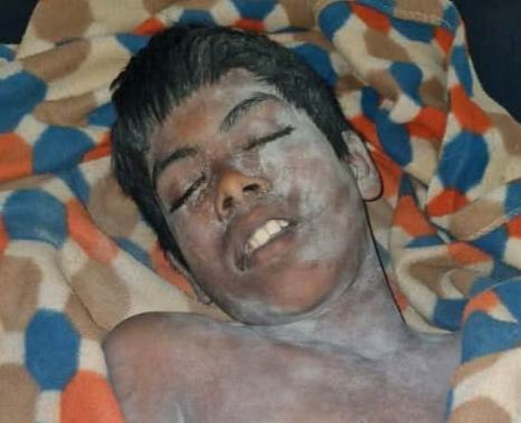 आकाशीय बिजली की चपेट में आने से किशोर की मौत