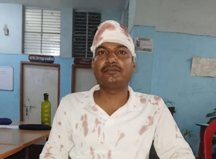 डुमरांव में जदयू नेता सह पूर्व वार्ड पार्षद को असामाजिक तत्वों ने पीटा, स्थानीय विधायक व समर्थकों पर लगाया आरोप