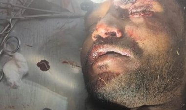 बिजली के पोल से टकराकर बाइक सवार युवक गंभीर रूप से जख्मी, सदर अस्पताल रेफर