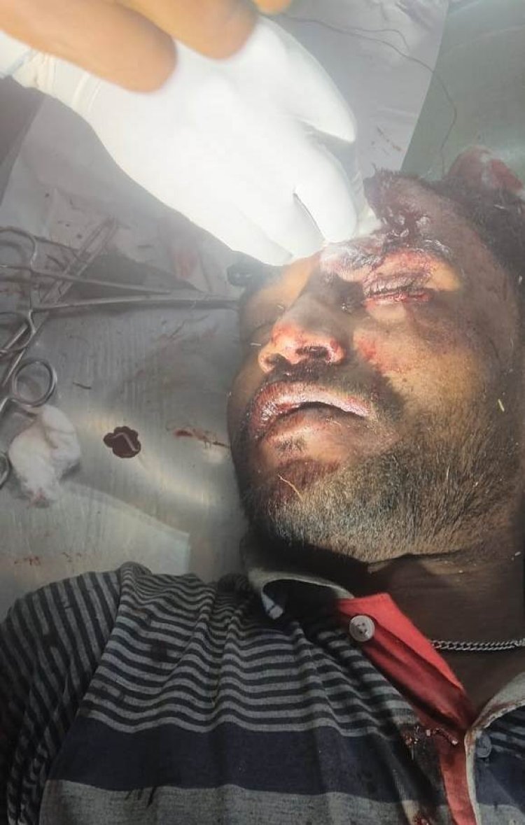 बिजली के पोल से टकराकर बाइक सवार युवक गंभीर रूप से जख्मी, सदर अस्पताल रेफर