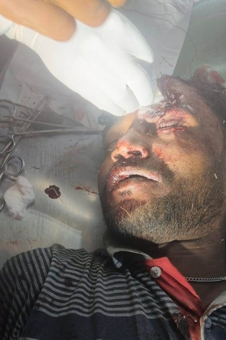 बैजनाथपुर नहर पुल के पास बाइक से गिरा था युवक, सदर अस्पताल में चल रहा इलाज