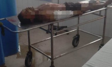 बक्सर के बंजरिया गांव में जमीन विवाद बना खूनी संघर्ष, बड़े भाई की मौत, महिला समेत दो घायल