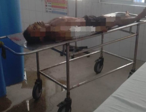 बक्सर के बंजरिया गांव में जमीन विवाद बना खूनी संघर्ष, बड़े भाई की मौत, महिला समेत दो घायल