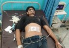 सिमरी में मामूली विवाद में 17 वर्षीय किशोर को मारी गोली, हालत गंभीर, विश्वामित्र हॉस्पिटल में चल रहा है इलाज